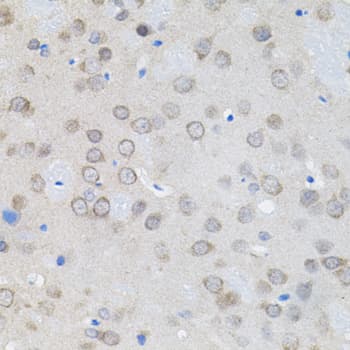 UBE2A Antibody
