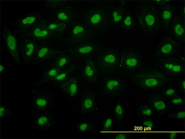 IHC-plus™ RBBP4 / RBAP48 Antibody (clone 2D7)