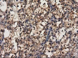 DSTN / Destrin Antibody (clone OTI2C10)