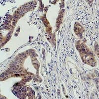 RAF1 / RAF Antibody