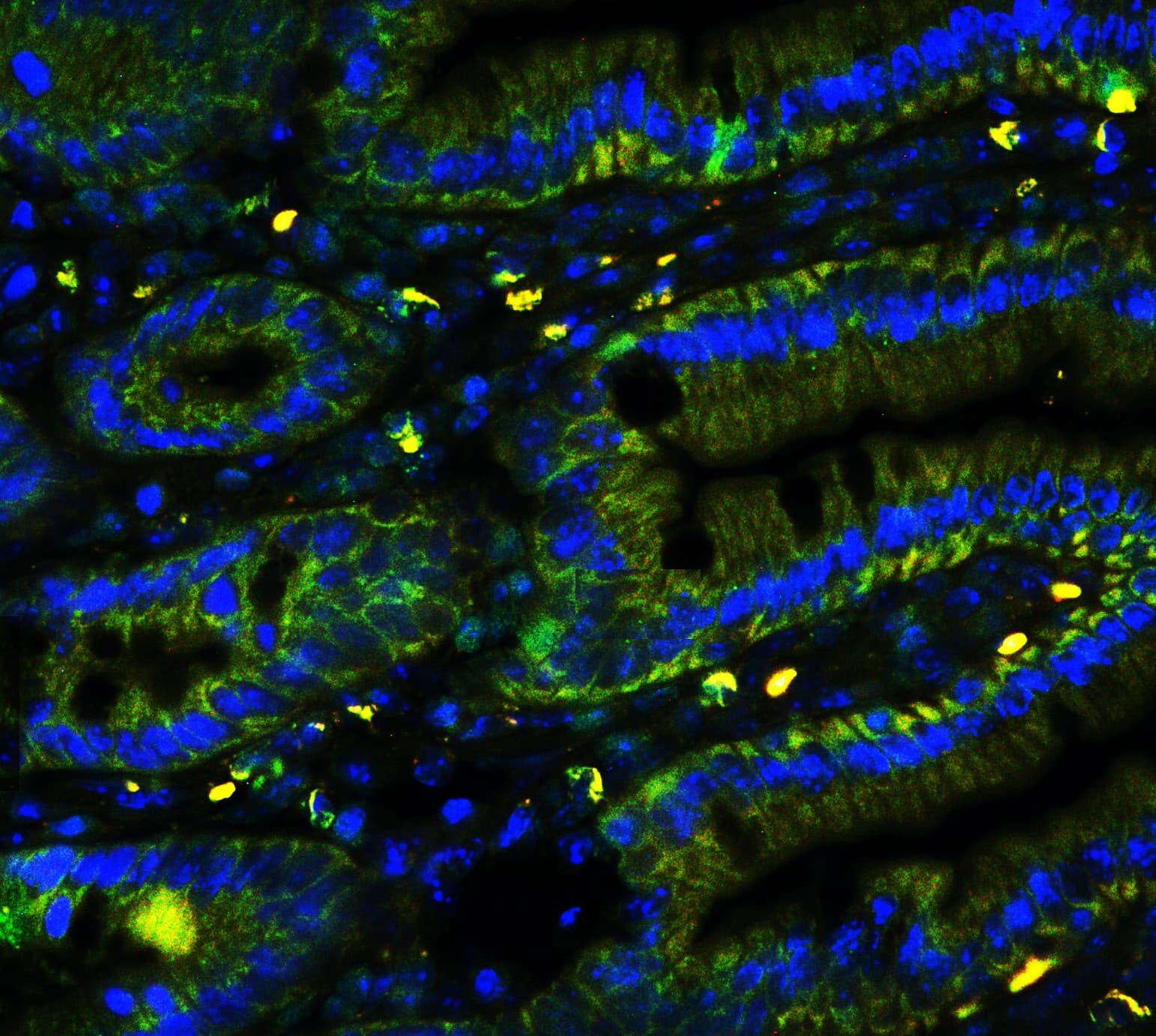 LGALS3 / Galectin 3 Antibody (aa139-250)