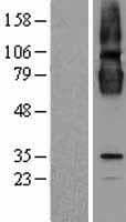 Human CLPTM1 Protein (Over-Expression Lysate Myc-DDK (Flag))