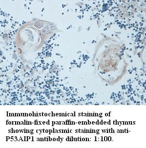 TP53AIP1 / p53 AIP1 Antibody (N-Terminus)