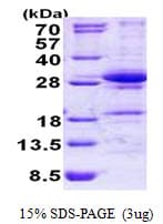Human DGCR6L Protein (Recombinant His)