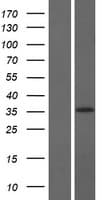 Human LRRC75A / C17orf76 Protein (Over-Expression Lysate Myc-DDK (Flag))