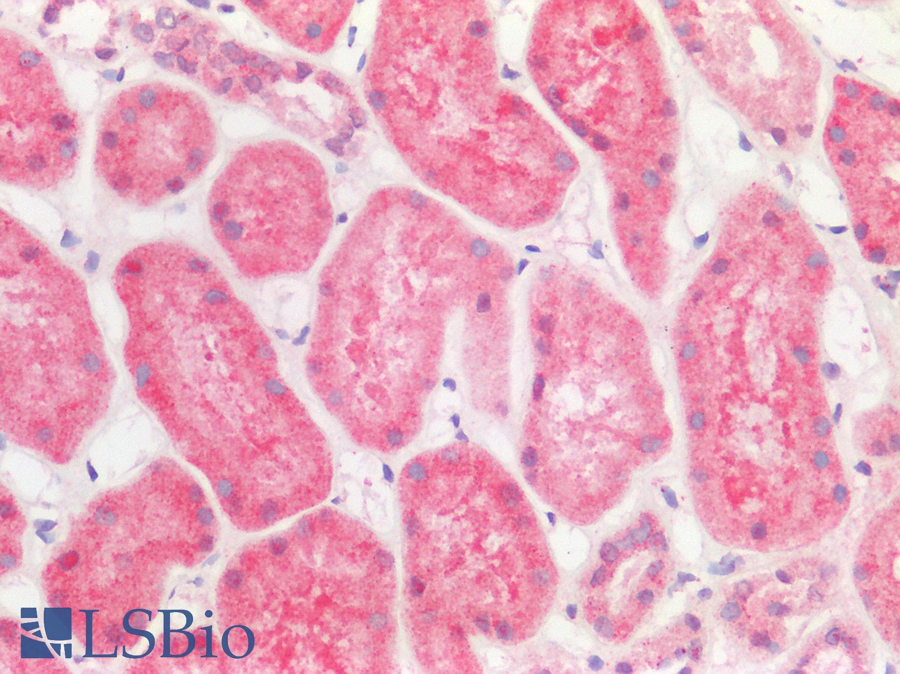 Polyclonal Rabbit anti-Human ALG11 Antibody (aa360-409, IHC, WB)
