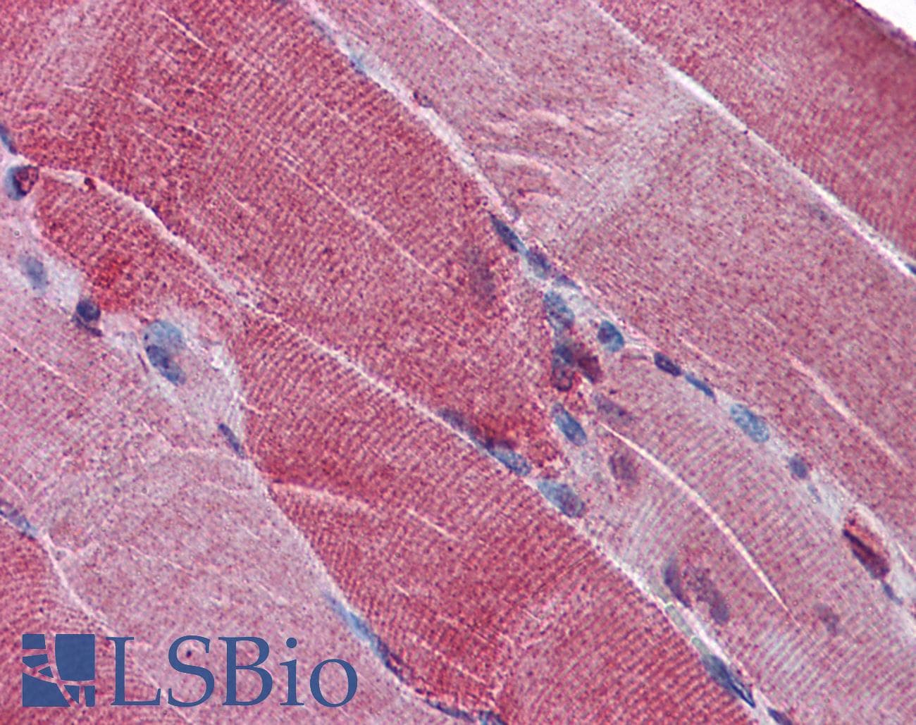 IHC-plus™ PACE4 / PCSK6 Antibody (aa830-841)