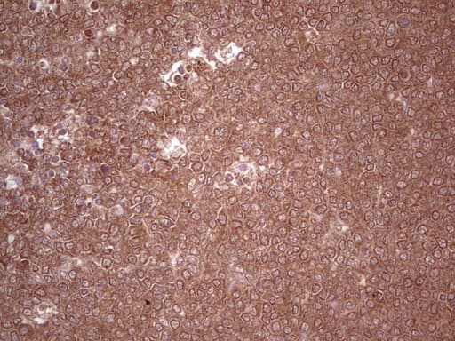 UBE2D2 / UBCH5B Antibody (clone OTI2C2)