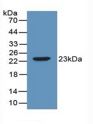 IL2 Antibody (aa10-169, FITC)