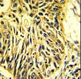 PROCR / EPCR Antibody (aa104-132)