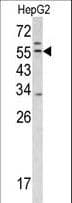 TMPRSS2 / Epitheliasin Antibody (aa314-343)