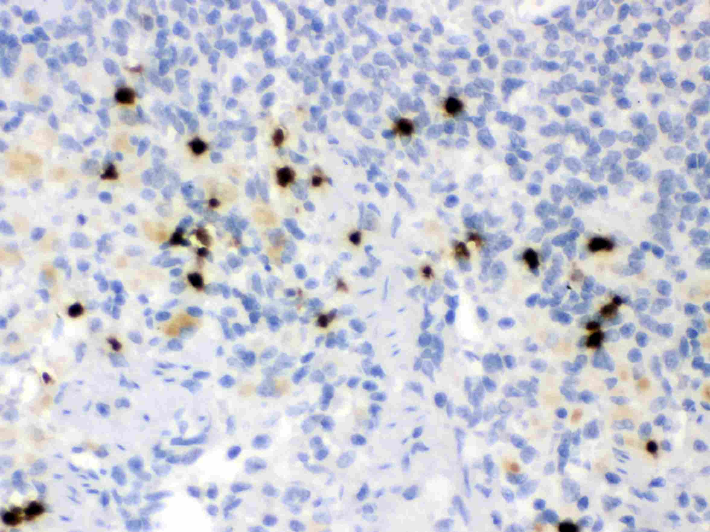 LCN2 / Lipocalin 2 / NGAL Antibody (aa21-200)