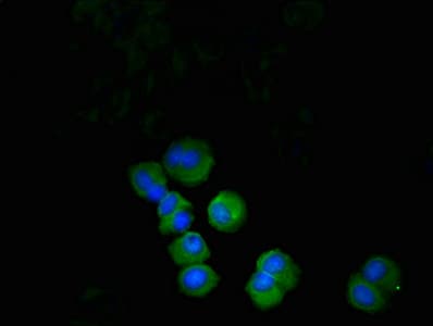Polyclonal Rabbit anti-Human PDCD1 / CD279 / PD-1 Antibody (IHC, WB)