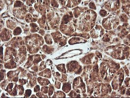 FAK / Focal Adhesion Kinase Antibody (clone OTI4A8)