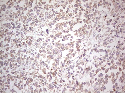 NEFM / NF-M Antibody (aa413-773, clone OTI5B7, Carrier-free)