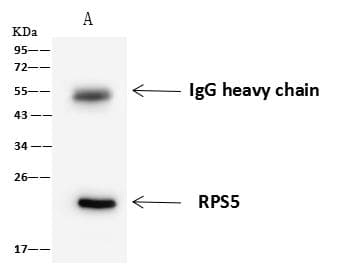 Polyclonal Rabbit anti-Human RPS5 / Ribosomal Protein S5 Antibody (IHC, IF, WB)