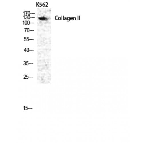 Polyclonal Rabbit anti-Human COL2A1 / Collagen II Alpha 1 Antibody (70-150 aa, N-terminal, IHC, IF, WB)