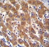 IRGM / LRG-47 Antibody (aa151-179)