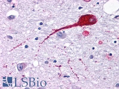 PathPlus™ NMUR2 Antibody (Cytoplasmic Domain)