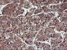 HDHD1 Antibody (clone OTI3E11)
