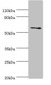DHCR24 / Seladin-1 Antibody (aa227-516)