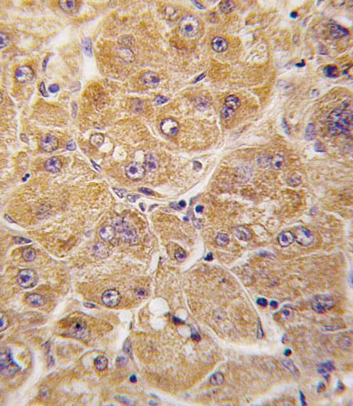 Polyclonal Rabbit anti-Human ALDH1A1 / ALDH1 Antibody (aa302-331, IHC, IF, WB)