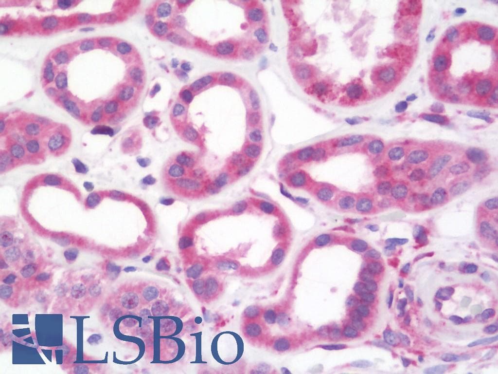 IHC-plus™ Polyclonal Rabbit anti-Human PFKP Antibody (aa350-400, IHC, WB)