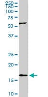 IHC-plus™ RHEB Antibody (clone 2C11)