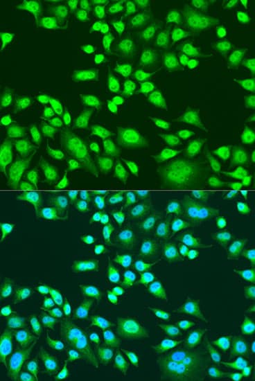 PAX8 Antibody