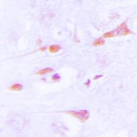 CaMKII Alpha+Delta Antibody (Internal)