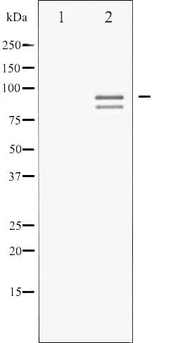 GYS1 / Glycogen Synthase Antibody (phospho-Ser645)