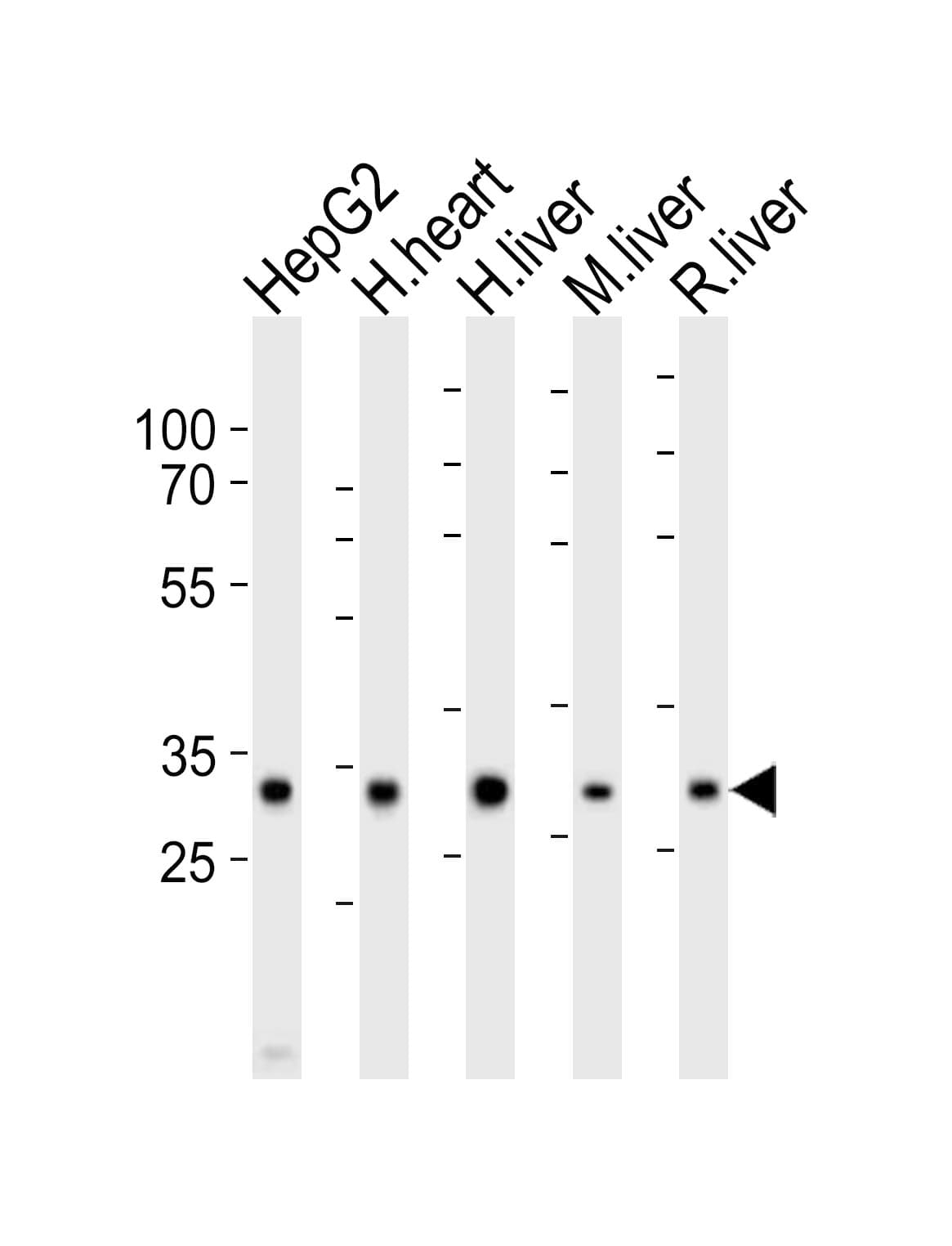 Polyclonal Rabbit anti-Human DECR1 Antibody (aa241-274, WB)