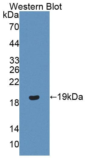 PR / Progesterone Receptor Antibody