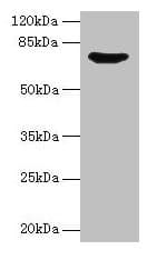 IHC-plus™ Polyclonal Rabbit anti-Human SYN1 / Synapsin 1 Antibody (aa113-420, IHC, WB)