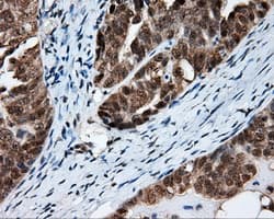 FAHD2A Antibody (clone OTI5H7)