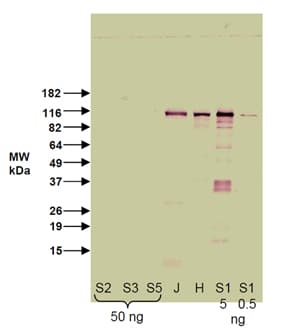 SIRT1 / Sirtuin 1 Antibody