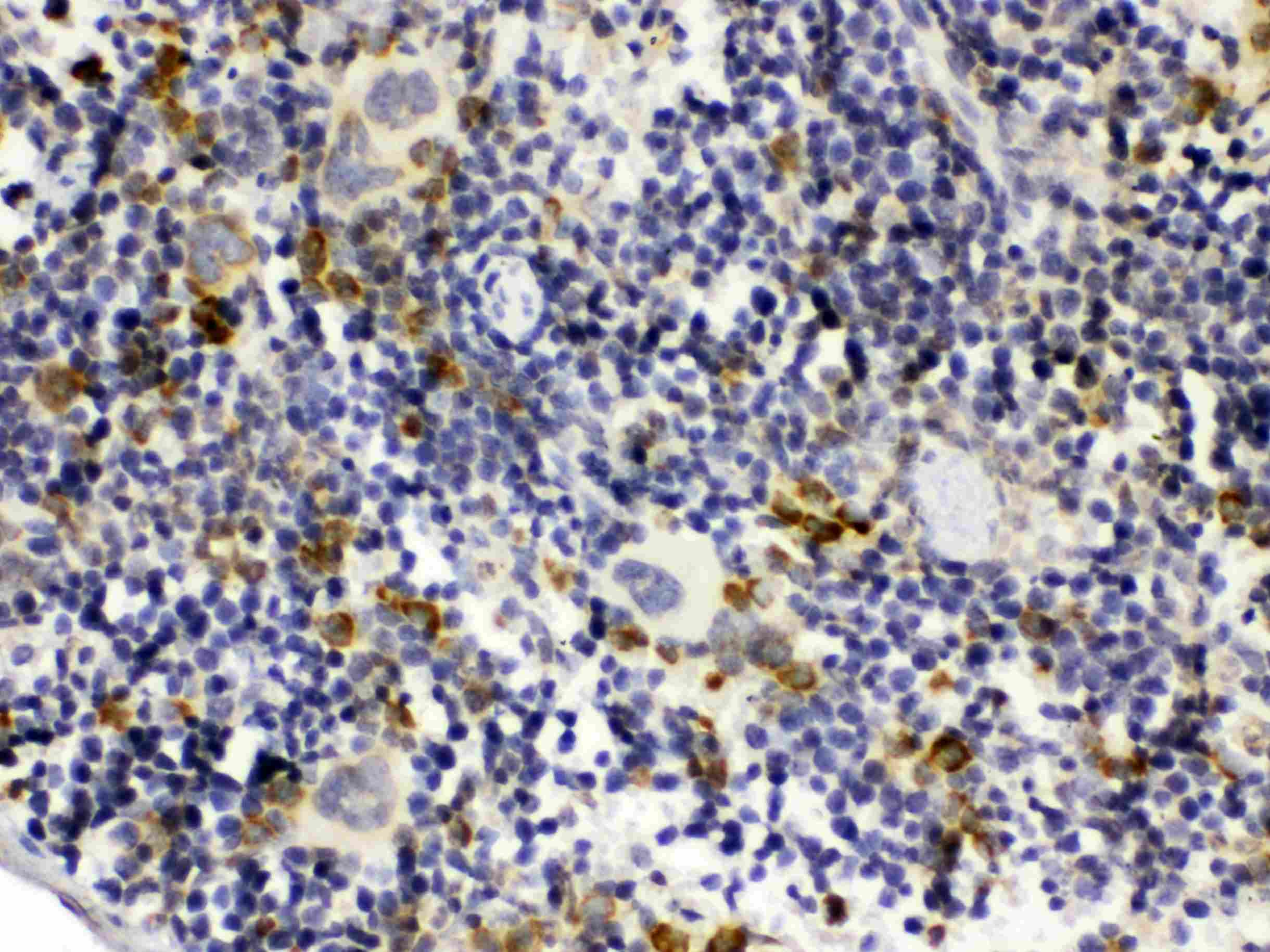 GC1qR / C1QBP Antibody