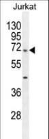 TBC1D3H Antibody (aa6-34)