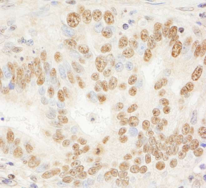 IHC-plus™ JHDM1A / KDM2A Antibody (aa825-875)