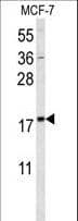 SUMO1 / SMT3 Antibody