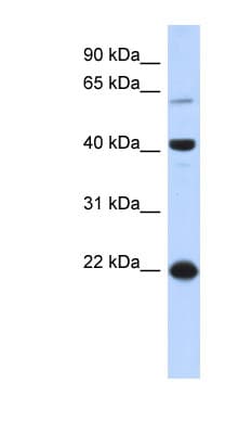 BLZF1 Antibody (aa71-120)