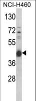 Polyclonal Rabbit anti-Human PRKACA + PRKACB Antibody (aa67-94, IHC, WB)