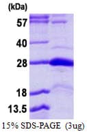 Human STYX Protein (Recombinant His)