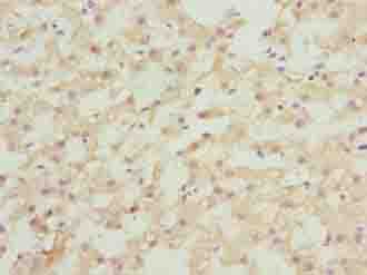 ASAP3 Antibody