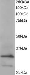 IHC-plus™ Polyclonal Goat anti-Human ARPC2 / p34-Arc Antibody (aa288-300, IHC, WB)