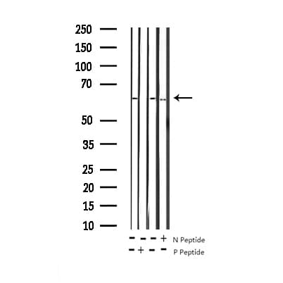 SMAD1 Antibody (phospho-Ser187)