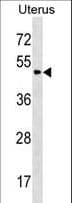 PLA2G3 Antibody (aa446-474)