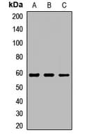 LPCAT1 / AYTL2 Antibody