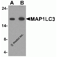 IHC-plus™ Polyclonal Rabbit anti-Human MAP1LC3 Antibody (IHC, WB)