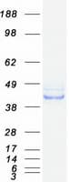 Human SERPINH1 / HSP47 Protein (Recombinant Myc-DDK (Flag))